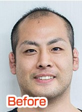 施術前