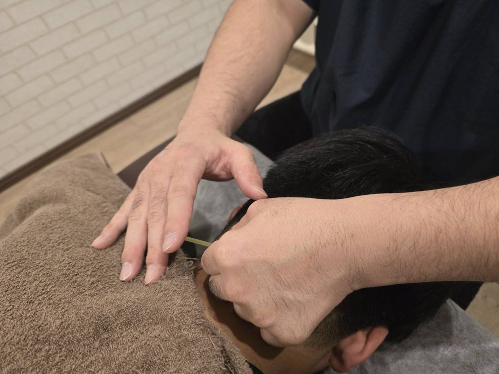 鍼灸施術