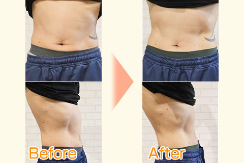 ビフォーアフター