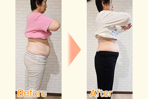 ビフォーアフター