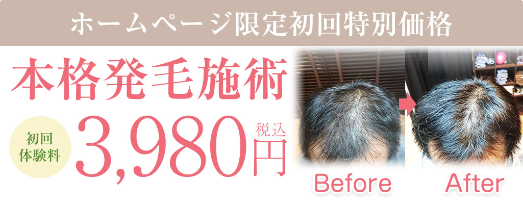 発毛オファーNEW